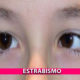 estrabismo