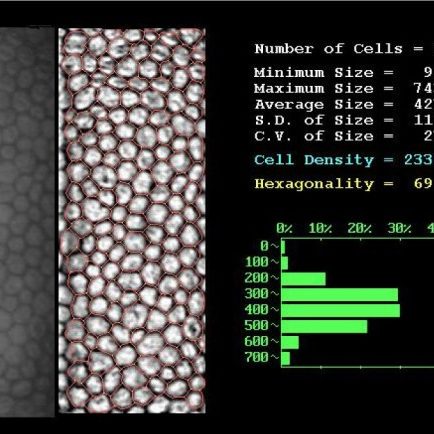 Microscopia especular