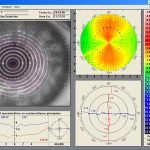 topografia corneal tomey