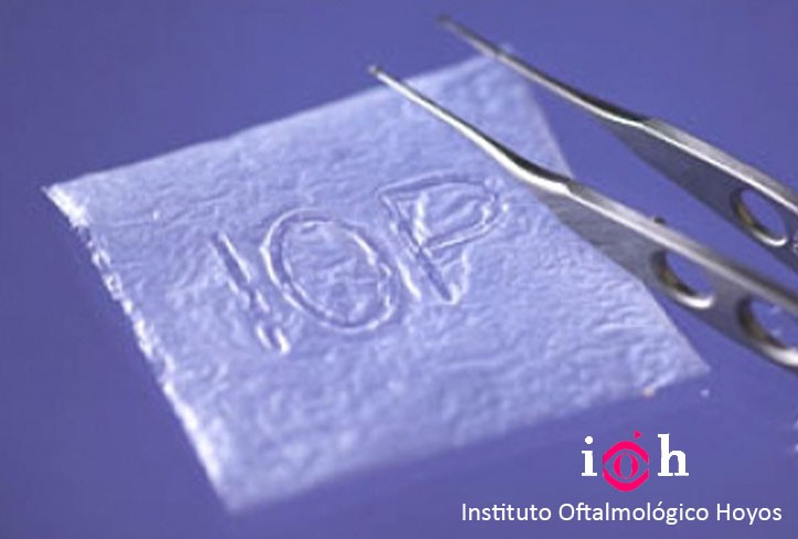 tras membrana amniotica