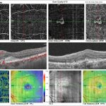 pruebas oftalmologicas
