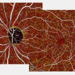 pruebas oftalmologicas