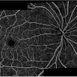 pruebas oftalmologicas