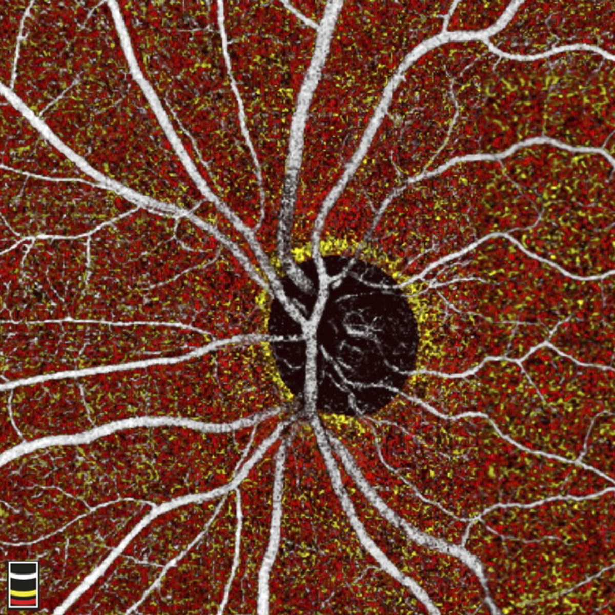 pruebas oftalmologicas