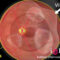 retina y vitreo retina y vitreo