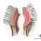 tratar-la-blefaritis tratar-la-blefaritis y cómo prevenir la blefaritis